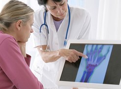 woman and doctor looking at x-ray of hand and discussing arthritis treatments