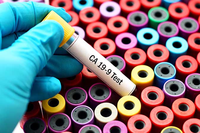 Testing for Pancreatic Cancer