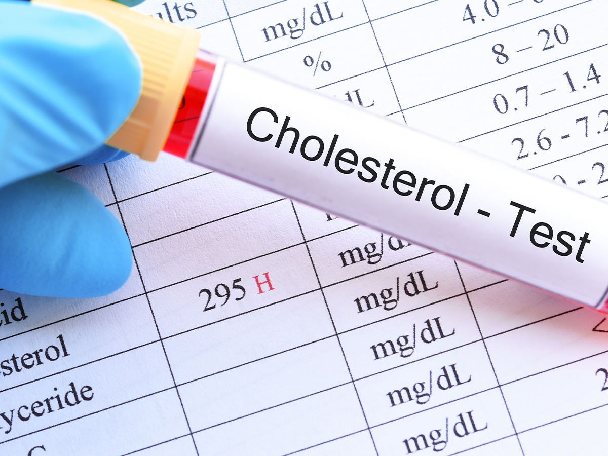 High Cholesterol