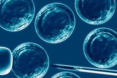 pro in vitro fertilization essay pro in vitro fertilization essay