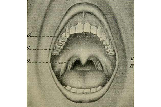 Surgery for Mental Illness