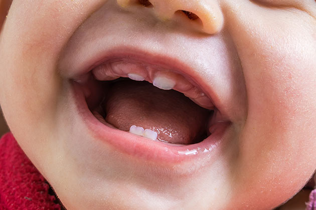 Releasing Teeth