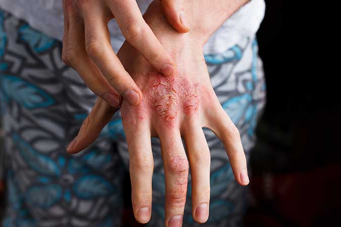Concerns: Softsoap Coconut & Warm Ginger Hand Soap