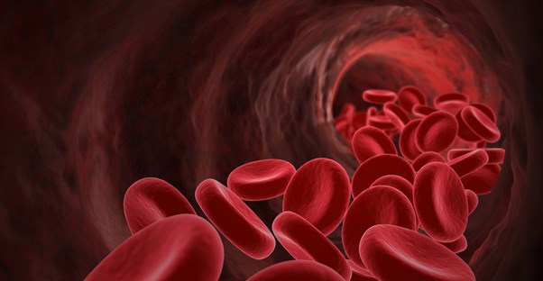 Understanding Sickle Cell Anemia